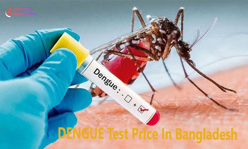 DENGUE Test Price In Bangladesh​