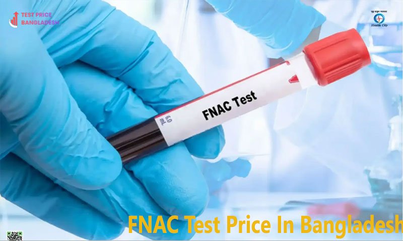 FNAC Test Price In Bangladesh​