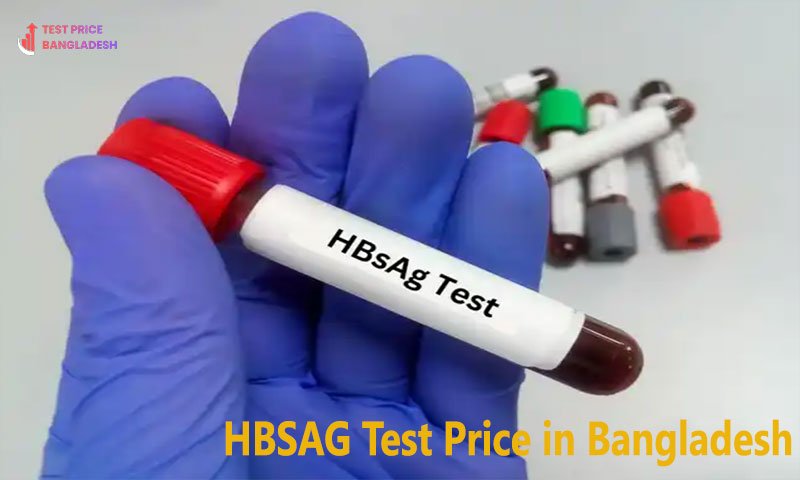HBSAG Test Price in Bangladesh