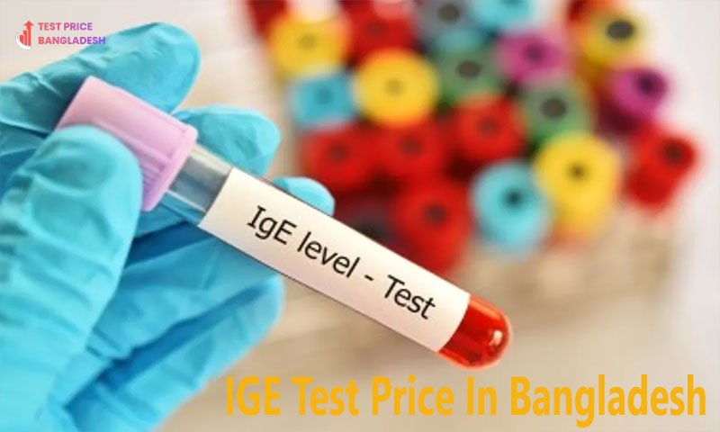 IGE Test Price In Bangladesh