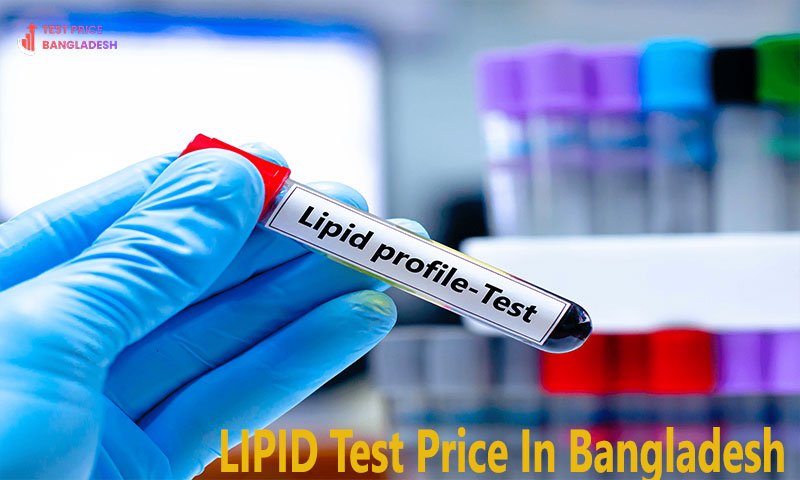 LIPID Test Price In Bangladesh