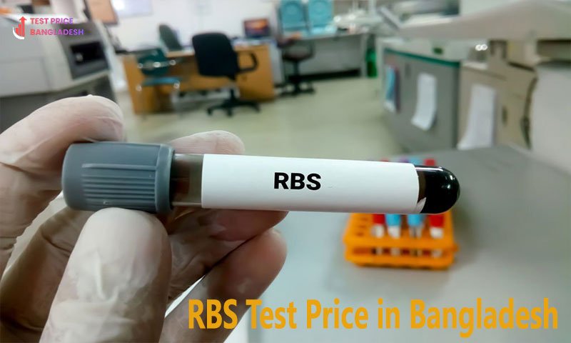 RBS Test Price in Bangladesh