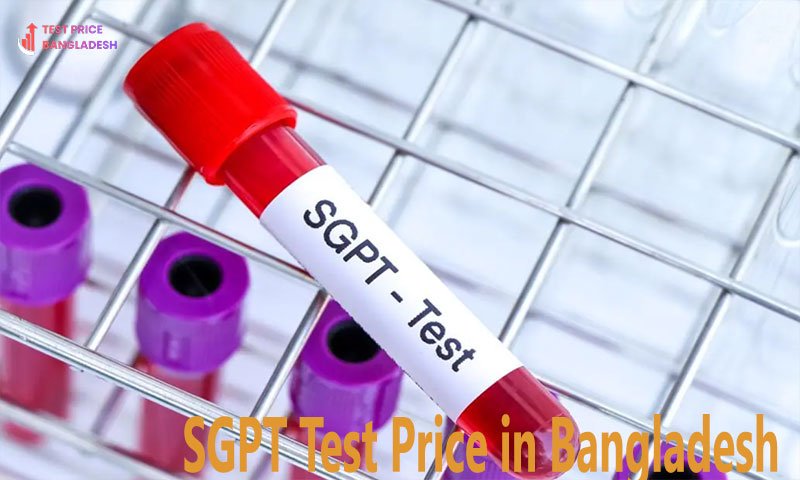 SGPT Test Price in Bangladesh