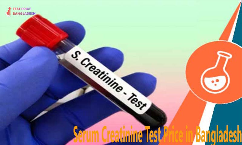 Serum Creatinine Test Price in Bangladesh