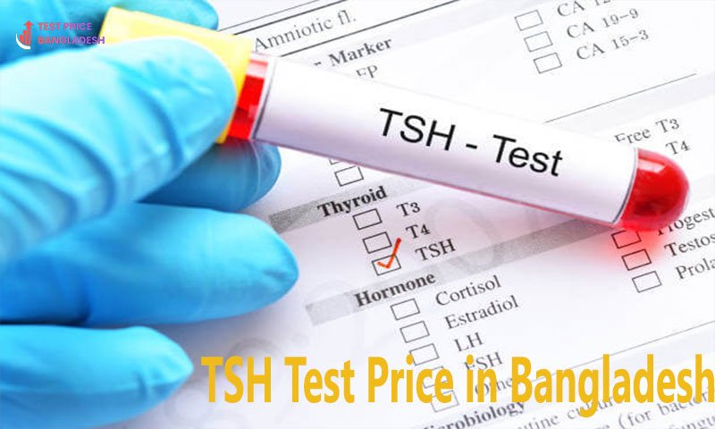 TSH Test Price in Bangladesh