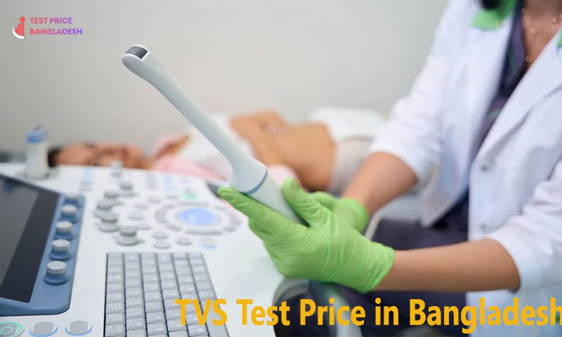 TVS Test Price in Bangladesh