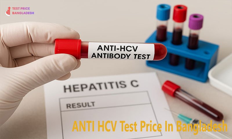 ANTI HCV Test Price In Bangladesh​