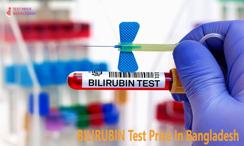 BILIRUBIN Test Price In Bangladesh