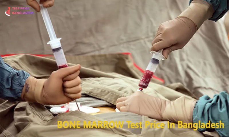 BONE MARROW Test Price In Bangladesh​