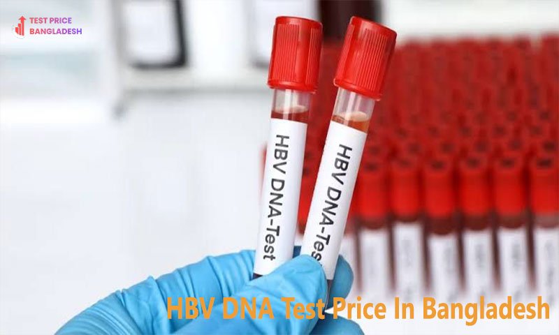 HBV DNA Test Price In Bangladesh​