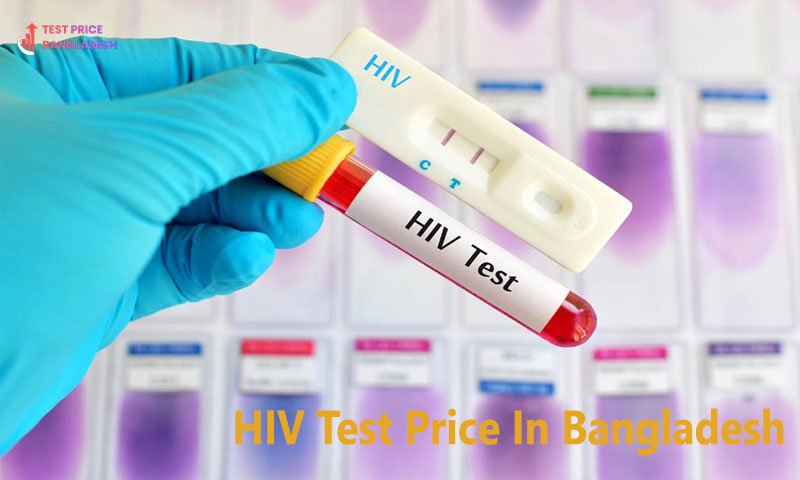 HIV Test Price In Bangladesh​