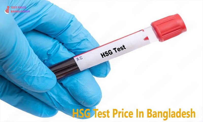 HSG Test Price In Bangladesh​
