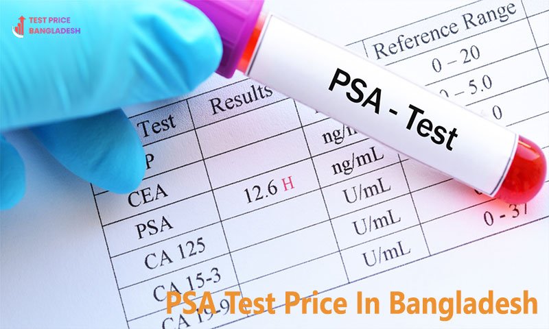 PSA Test Price In Bangladesh​