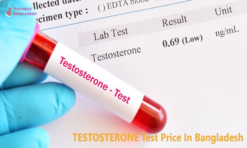 TESTOSTERONE Test Price In Bangladesh​