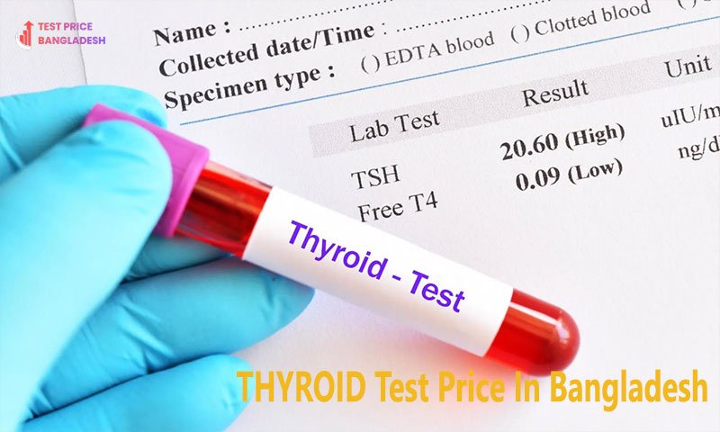 THYROID Test Price In Bangladesh​