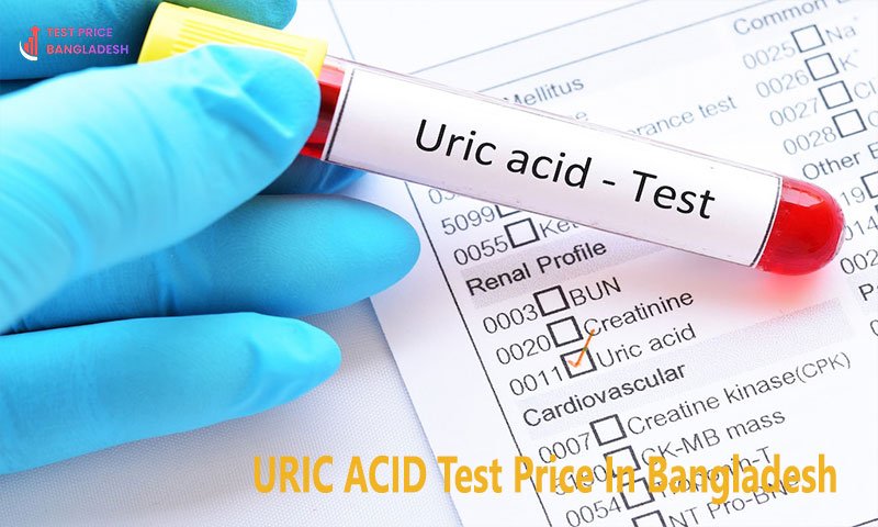 URIC ACID Test Price In Bangladesh