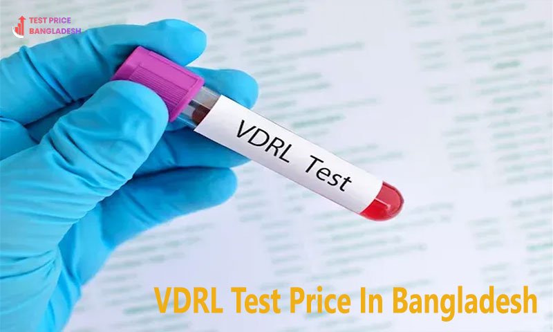 VDRL Test Price In Bangladesh​