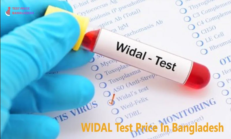 WIDAL Test Price In Bangladesh​