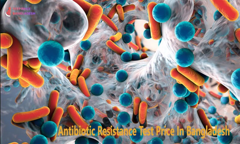 Antibiotic Resistance Test Price In Bangladesh