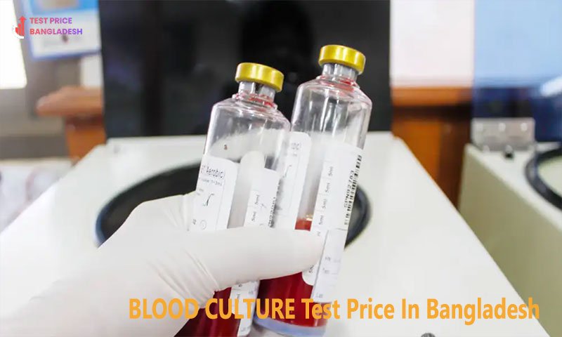 BLOOD CULTURE Test Price In Bangladesh