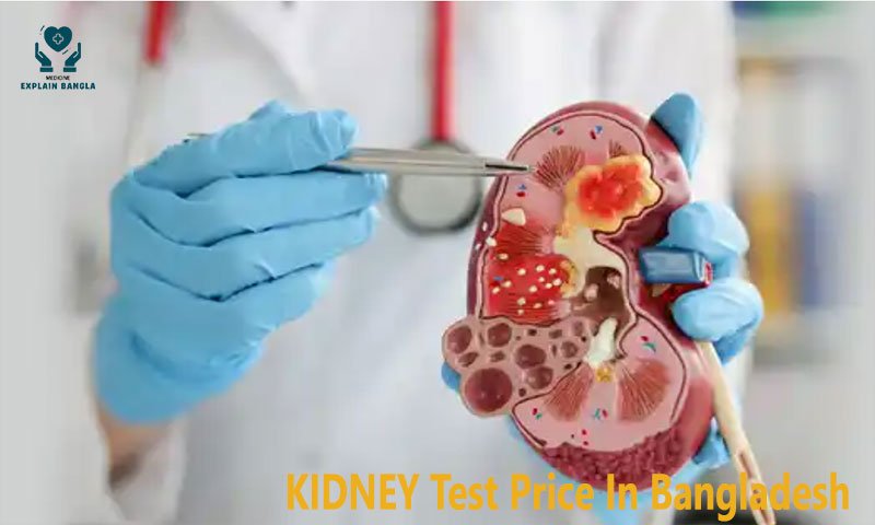 KIDNEY Test Price In Bangladesh