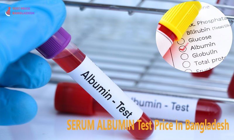 SERUM ALBUMIN Test Price In Bangladesh